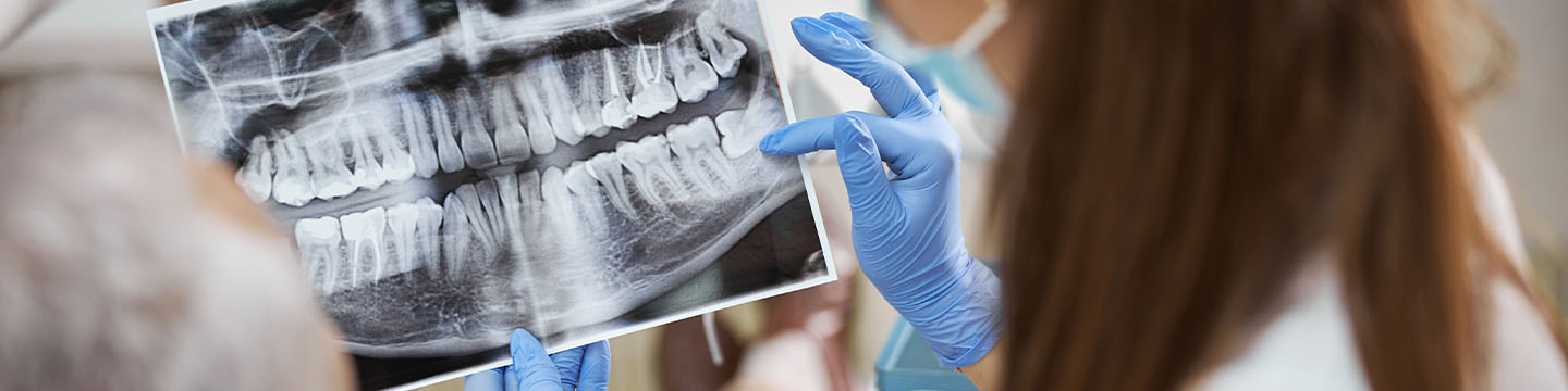 Diş ve dental tomografi incelemesi