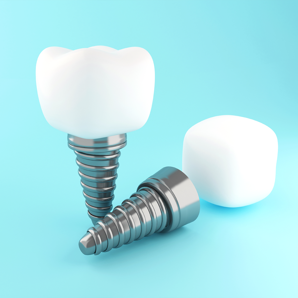 Dental implant parçaları