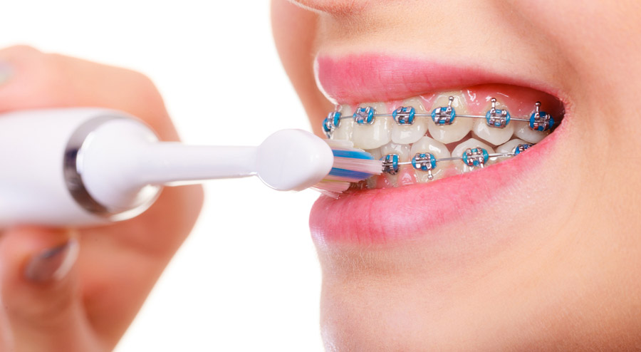Diş teli olan kadın elektrikli diş fırçası kullanıyor