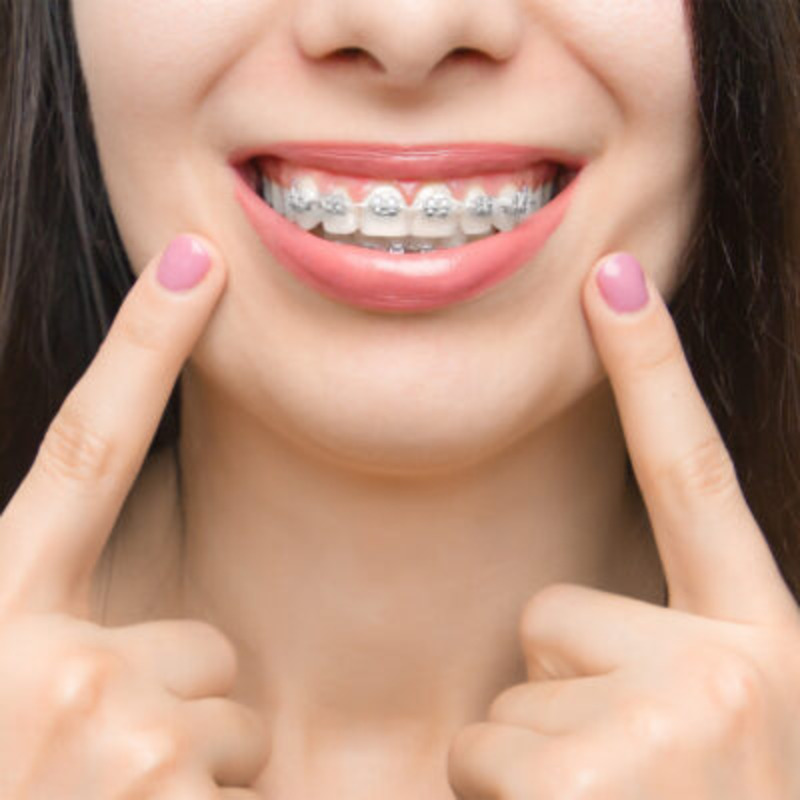 Endodonti tedavisi görmüş Özel Dental hastası